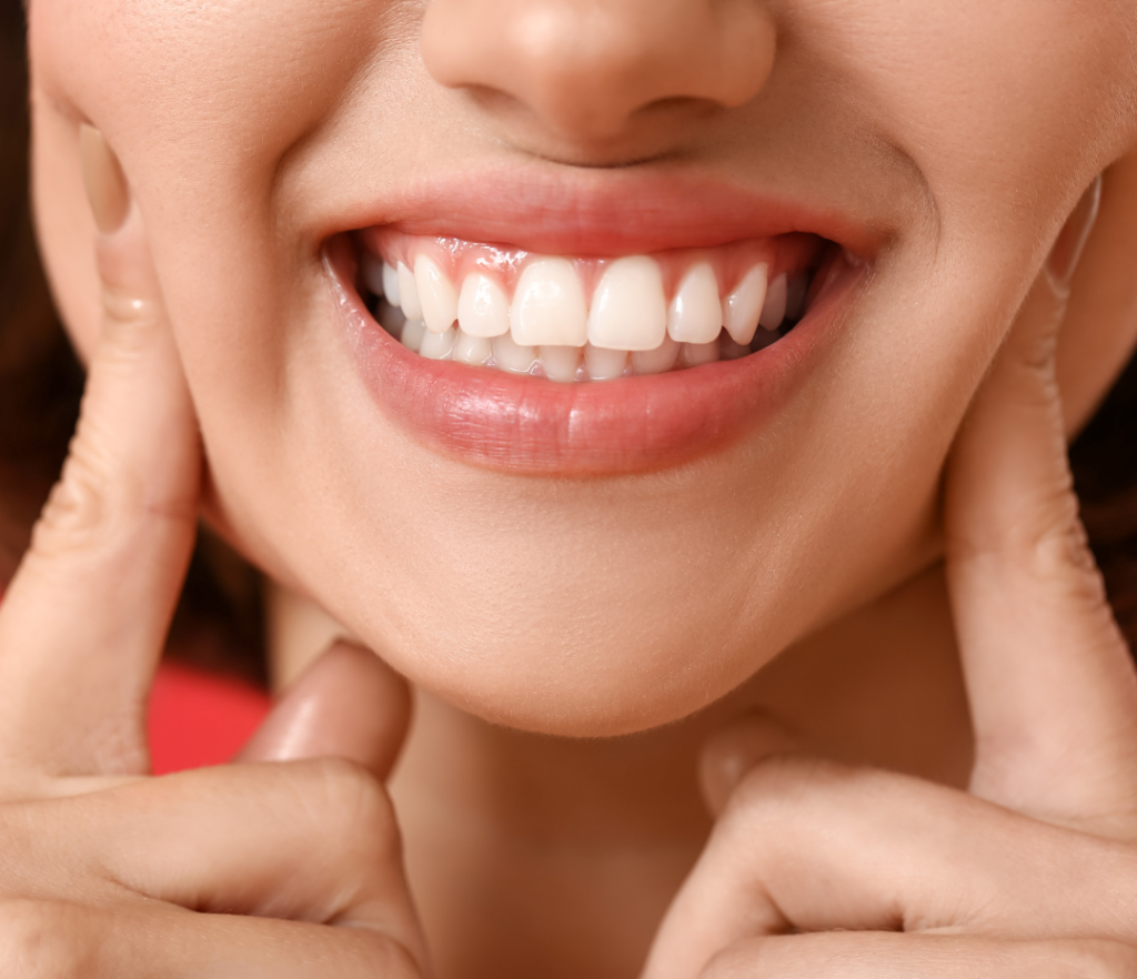 Smiling woman showcasing healthy teeth and wellness based oral health.